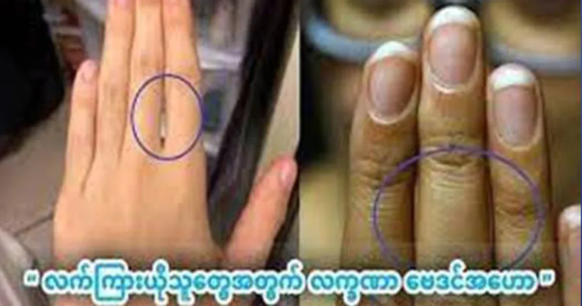 If you are a {hand leak symptom}, don't skip this post and read it
